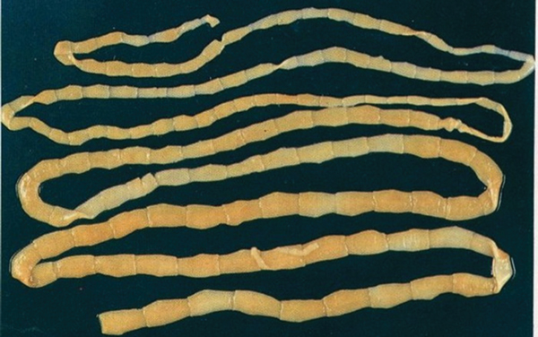Sán dây bò ký sinh tại ruột người, dài khoảng từ 4 – 12 m